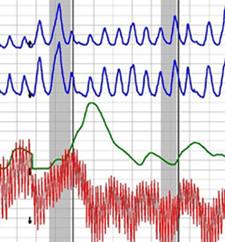 expert polygraph test in Los Angeles